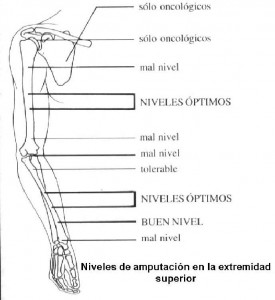 Módulo de amputados