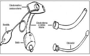 traqueostomia fenestrada